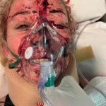 Taylah McCutcheon suffered a horror crash in training